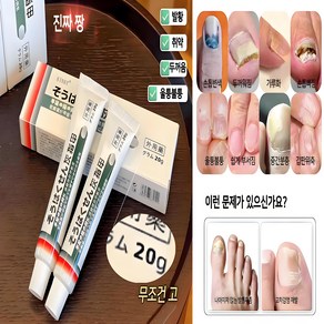 {약국강력 추천} 발톱무좀크림 발톱무좀 발톱 빠진다 발톱 변색발톱 두꺼워짐 발톱 갈라짐, 1개, 20g