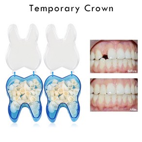 5 개상자 임시 5pcs 치아 전방 후방 재료 도구, 단일옵션, 1개