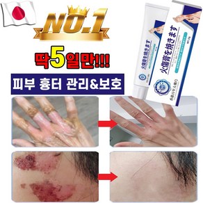 일본기술 1/1+1 화상 연고 흉터 상처 제거 재생 크림 피부 관리 케어, 2개, 25g