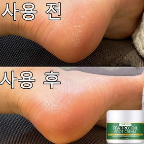 SILIYOUNG 2+1/3+2 고보습 발각질연화제 발크림 발각질크림 발각질제거, 50g, 1개, 1개입