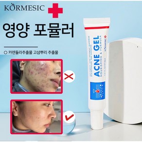 [약국 직판]KORMESIC여드름 연고 민감한 피부를 위한 첫 번째 미국 FDA 인증 브랜드 획득 여드름 빨리 없애세요 수리 장벽 여드름 자국 여드름 흉터W009, 2개, 30ml