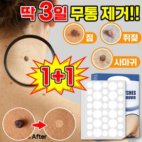 [빠른배송] 피부 제거 패치 얼굴 바디 피부 치료 라벨 스텔스 포장증정