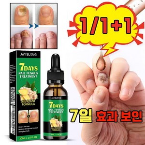 [국내배송] 손톱 발톱 무좀약 내성발톱 치료 문제성발톱 셀라솔루션 발톱연화제 케어 앰플 손발톱 영양제, 2개, 30ml