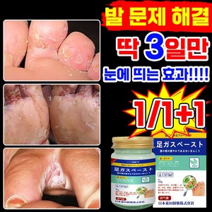 [빠른배송] 발 연고 발 가려움 발냄새 발각질 제거 크림 억제 포장증정, 2세트, 50g