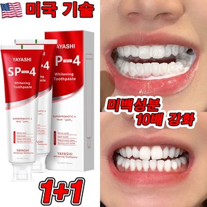 미국 SP4 1+1/2+2 고불소 미백 치약 프로바이오틱 치약 화이트닝 잇몸붓기 염증 예방 구취케어 치약, 2개, 120g