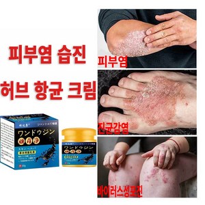 항균소염크림 건선/습진/붉은피부/모기물림/ 두드러기/피부염/두피선/피부소양증, 2개, GH12