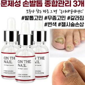 비비룩 온더네일 에센스, 20ml, 3개