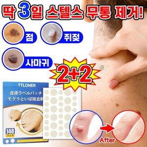 [효과보증!!] 피부 제거 패치 얼굴 바디 손 발바닥 피부 치료 스텔스 라벨, 4개