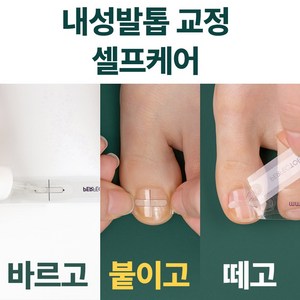 [특허인증 의료기기] 퍼펙토 내성발톱 교정기 스트립 의료기기 자가치료 교정 세트, 18mm, 1세트