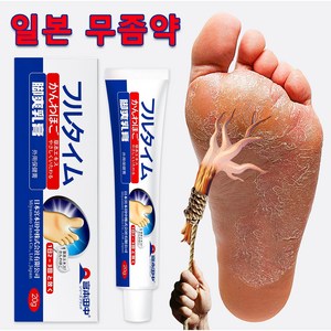 발냄새/발바닥가려움/발에 땀이나고피부가벗겨지고 물집이생기는 증상 SM004, 2개, 20g