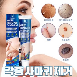 {아메리칸테크놀로지스  당일배송}빠른해결  편평사마귀  사마귀  목살사마귀  얼굴살 알갱이  LY017, 1개, 20g