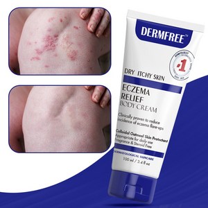 DERMFREE 건선 연고 두드러기 피부 가려움 크림, 2개, 100ml