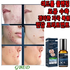 GBED 여드름 에센스 흉터 치료 제거 리페어 문제피부 자국 모공 진정 피지케어 올리고펩티드 세럼 랜덤증정, 1개, 30g