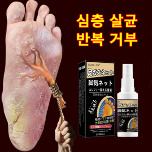 무좀을 겨냥하다 연구개발한 미스트, 1개입, 1개, 30ml