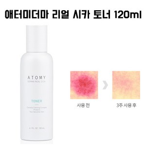 애터미 더마 리얼 시카 토너, 2개, 120ml