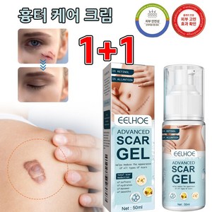 미국기술 1+1 흉터 제거 연고 수술 화상 상처 색소침착 연고 포장증정, 2개, 50ml