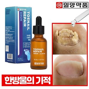 일양약품 문제성 손발톱 전문 리페어 세럼 영양제 토네일, 1개, 30ml