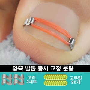 루리온 내성발톱 내향성발톱 파고드는발톱 엄지발톱 교정기, 1개