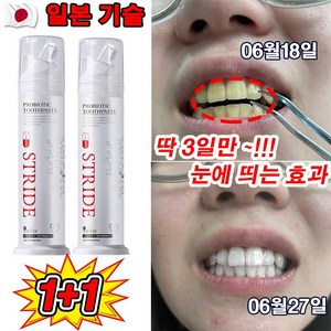 [딱 3일만] 일본 1/1+1 누렁이 미백 치약 구취케어 착색제거 충치예방 치아 미백제, 100g, 2개