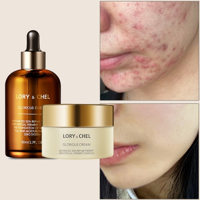 로리앤첼 글로리어스 수분 보습 크림 & 에센스 세트, 1세트