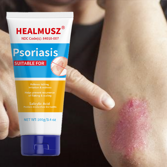 HEALMUSZ 건선크림 가려움 피부 완화  땀포진 두드러기 건선 습진 모낭염 지루성 피부염