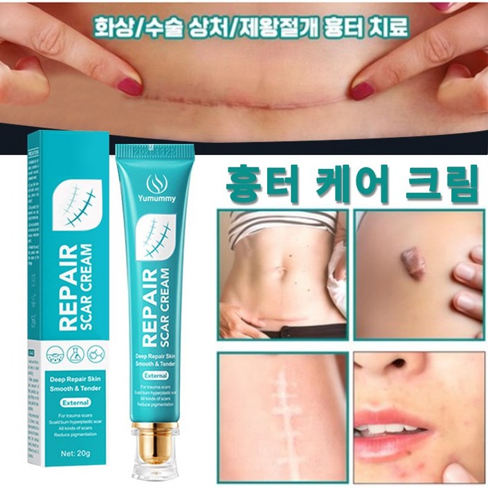 흉터제거연고화상수술흉터 흉터 연고 화상연고
