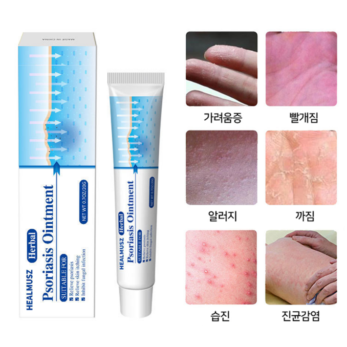 소양증 A04
