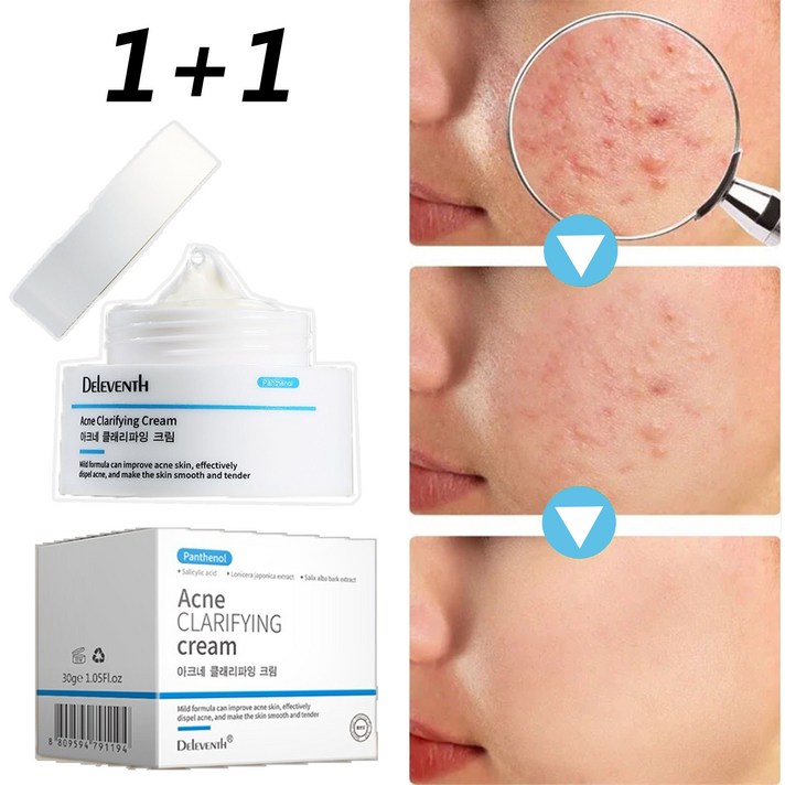 제거효과 MAX여드름 크림 천연 식물 성분 리페어 크림 민감피부 개선