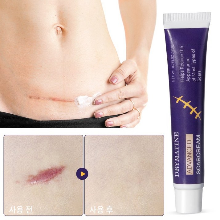 DRYMATINE 흉터연고